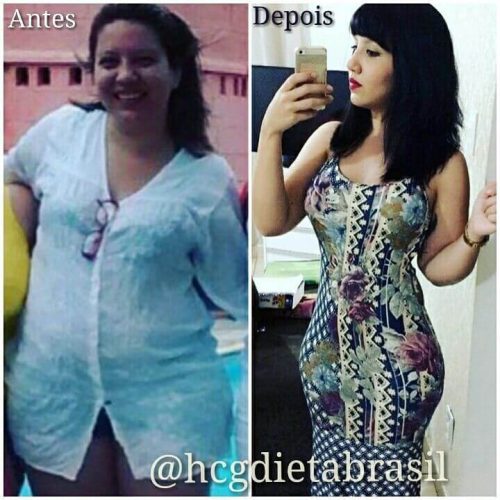 antes e depois