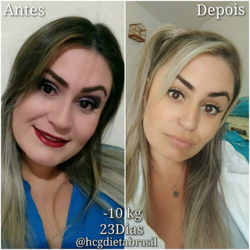 antes e depois