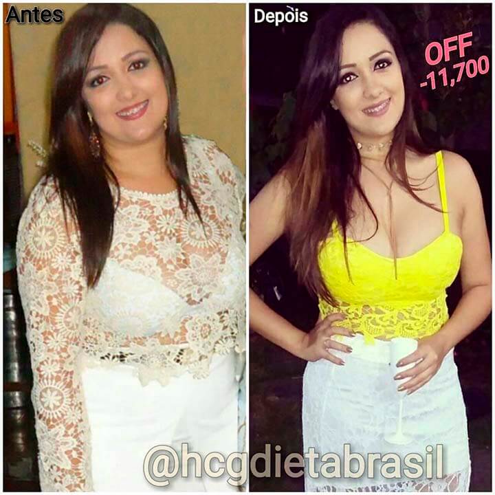 antes e depois