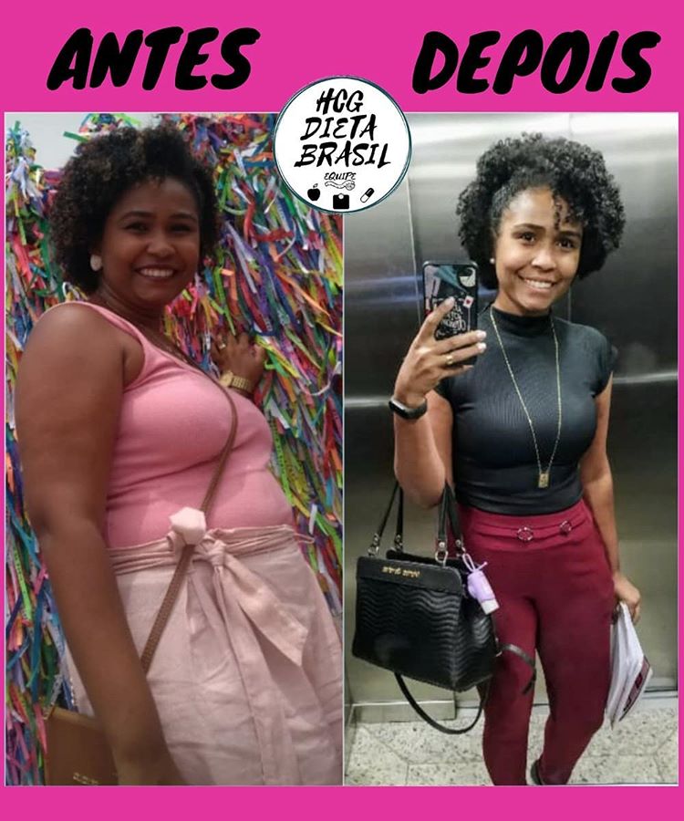 antes e depois