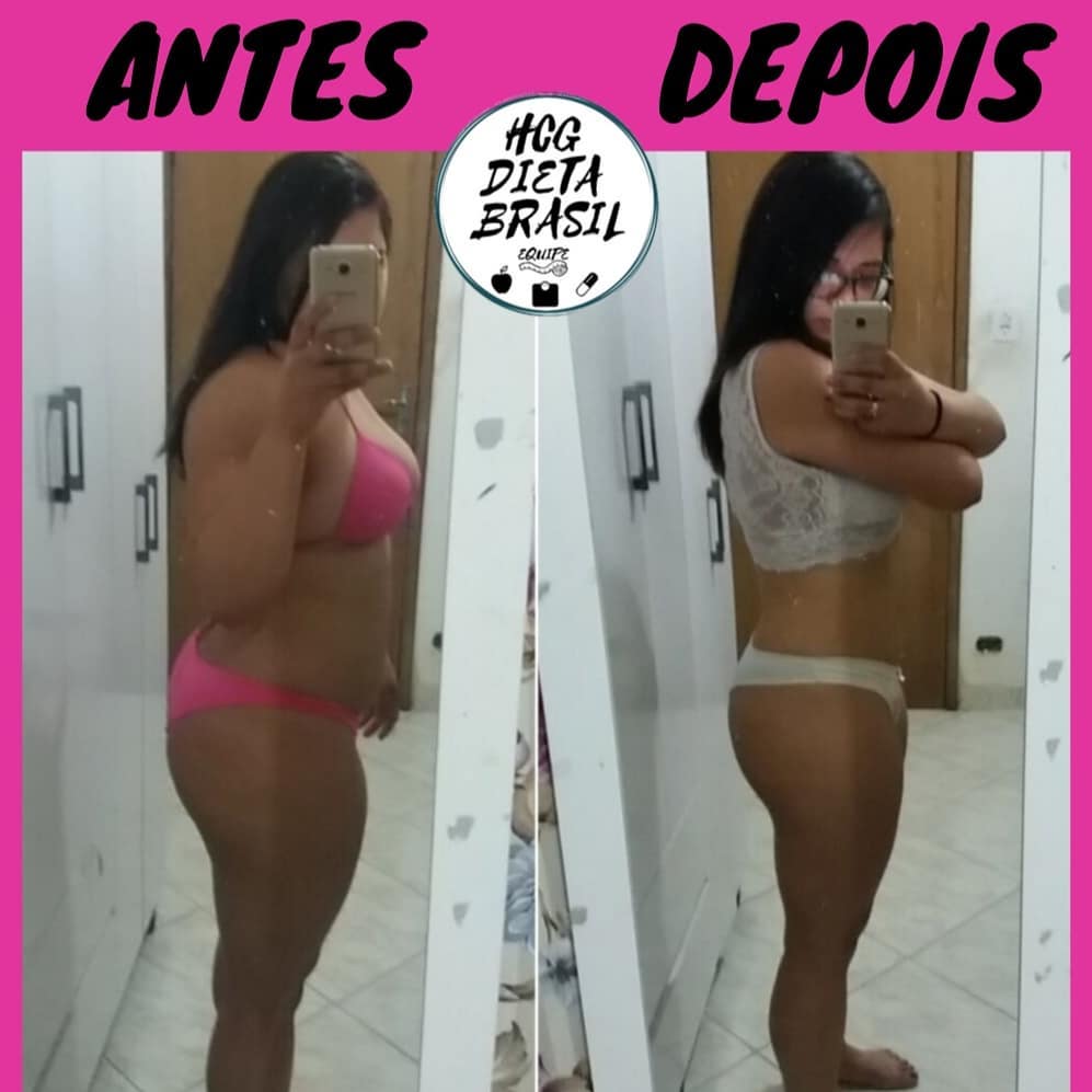antes e depois